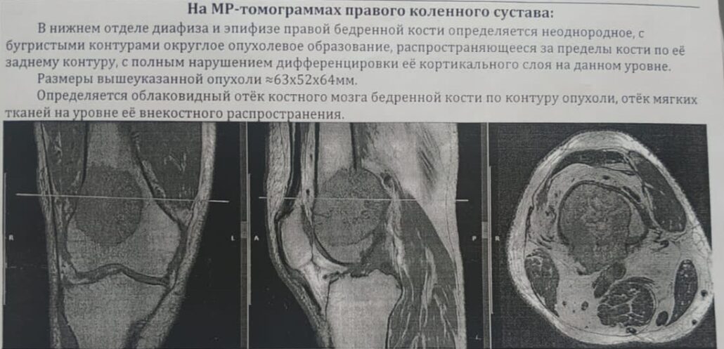 Барашев А.А. - травматолог онколог в Ростове 