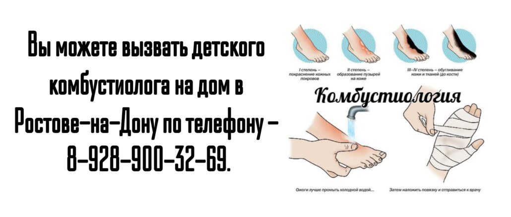 Ростов детский комбустиолог на дом