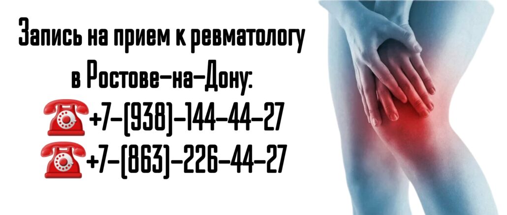 Ростов ревматолог Куликов А.И. - Псориатический артрит