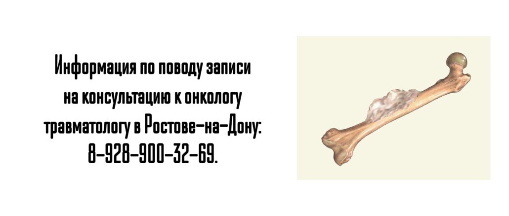Ростов травматолог онколог - Барашев Артем Андреевич