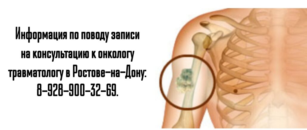 Ростов травматолог онколог - Барашев Артем Андреевич