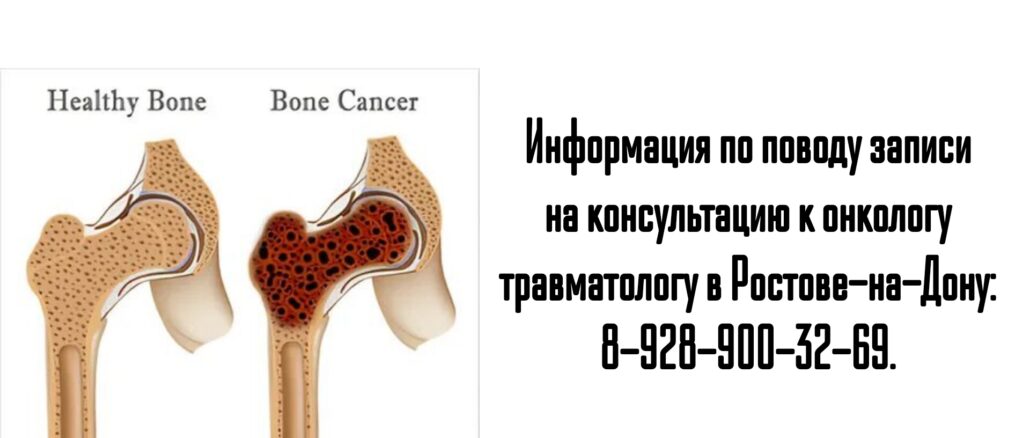 Ростов травматолог онколог - Барашев Артем Андреевич