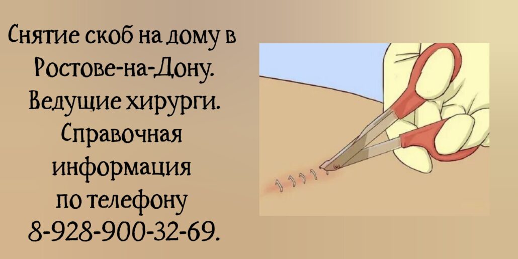 Хирург на дом Ростов - снять скобы