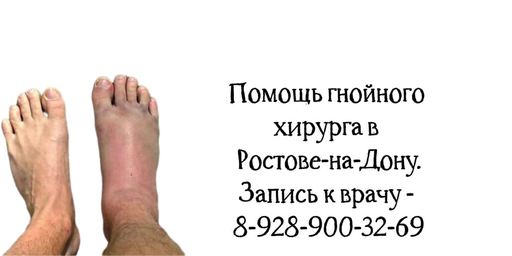 Ростов гнойный хирург Пак Евгений Олегович 