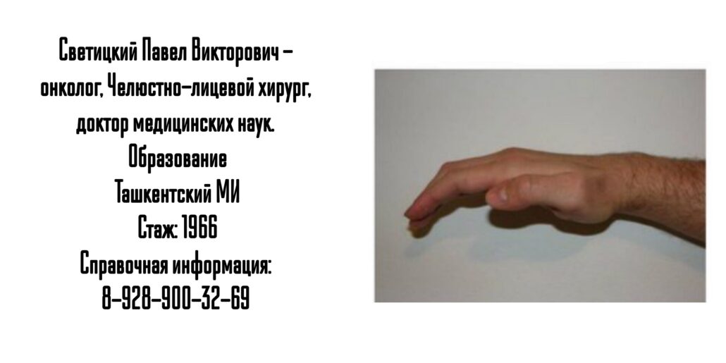 Силецкий Игорь Олегович - Синдром карпального канала — лечение Ростов 