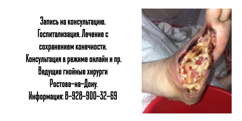 Ведущий гнойный хирург в Ростове-на-Дону 