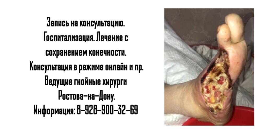 Ведущий гнойный хирург в Ростове-на-Дону 
