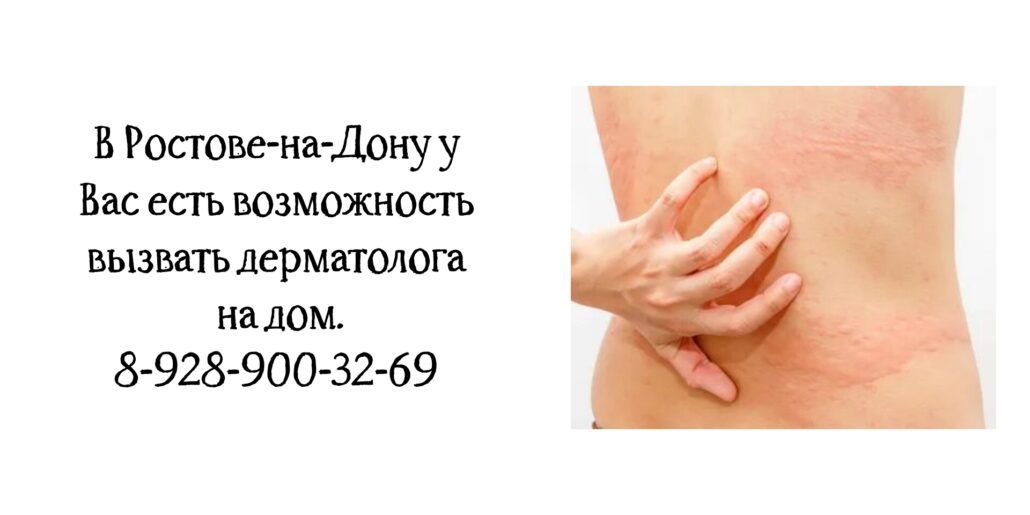 Вызвать дерматолога на дом в Ростове 