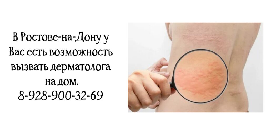 Вызвать дерматолога на дом в Ростове 