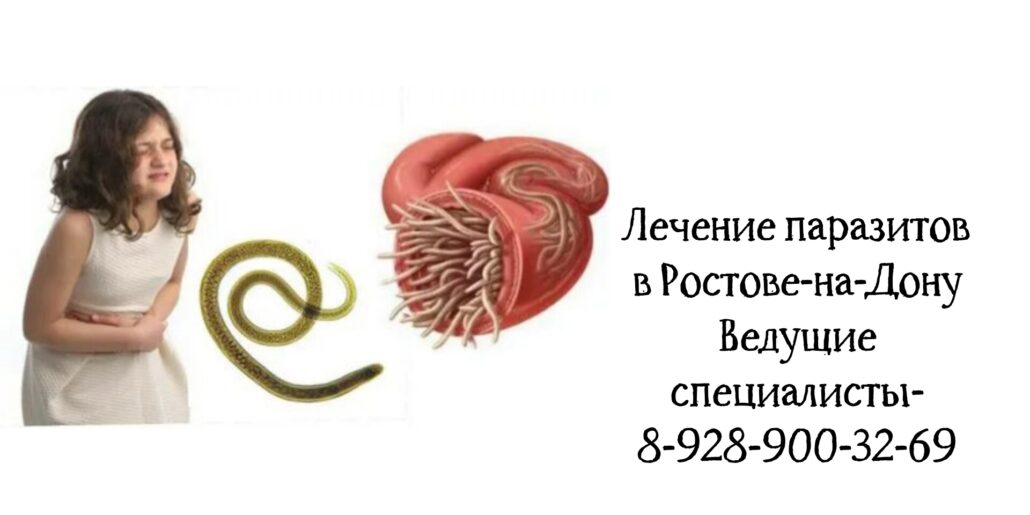 Ермакова Лариса Александровна - Паразитолог в Ростове-на-Дону