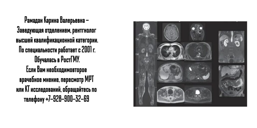 Ростов пересмотр дисков кт МРТ - Рамадан Карина Валерьевна