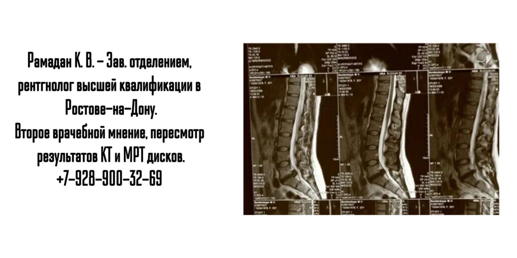 Ростов пересмотр дисков кт МРТ - Рамадан Карина Валерьевна