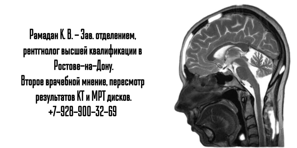 Ростов пересмотр дисков кт МРТ - Рамадан Карина Валерьевна