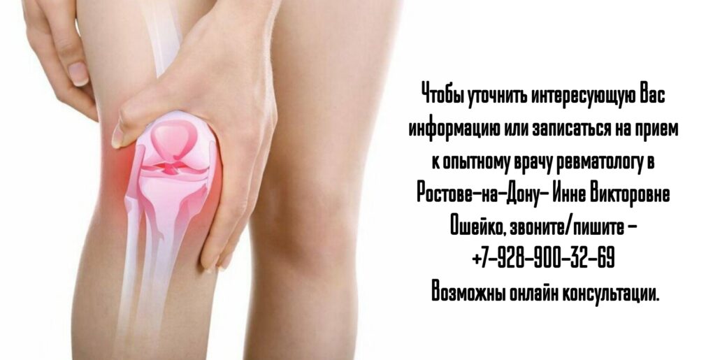 Ошейко Инна Викторовна- ревматолог в Ростове 