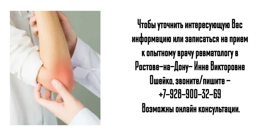 Ошейко Инна Викторовна- ревматолог в Ростове 