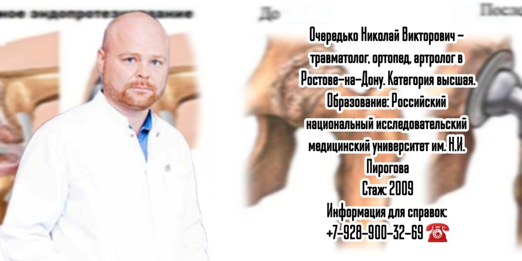 Хороший артролог Ростов - Очередько Николай Викторович