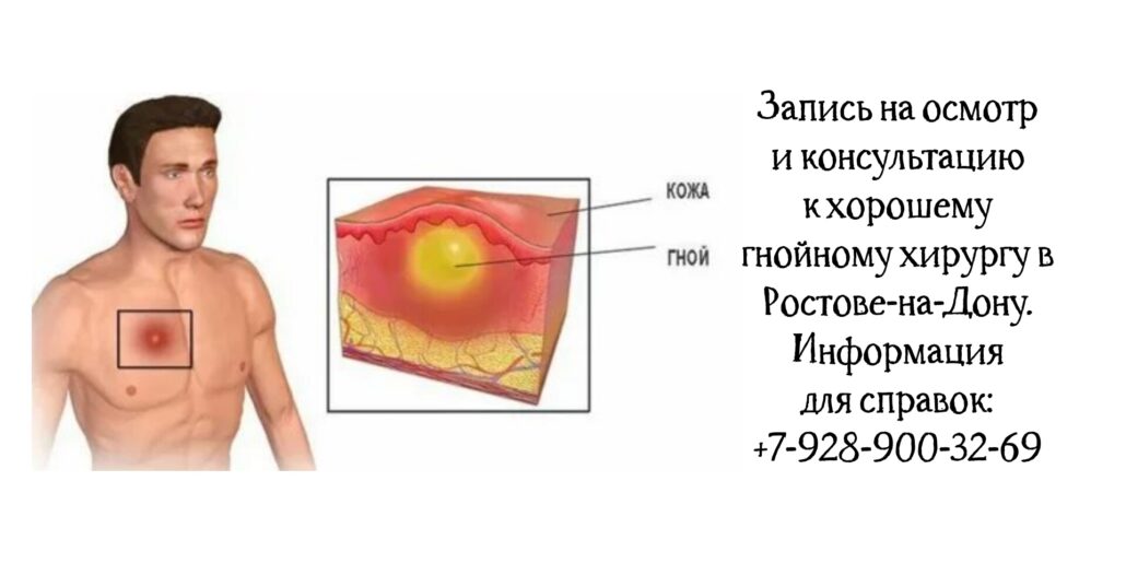 Хороший гнойный хирург в Ростове - Штильман Михаил Юрьевич 