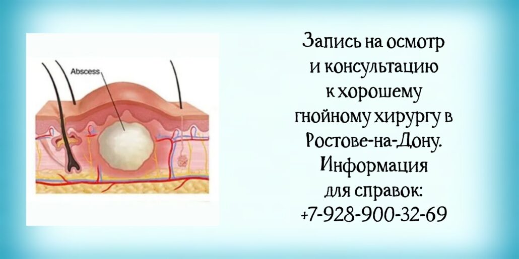 Хороший гнойный хирург в Ростове - Штильман Михаил Юрьевич 