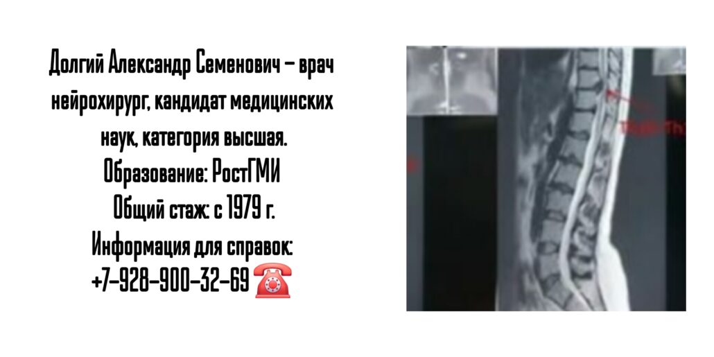 Ростов ведущий невролог нейрохирург протрузии грыжи - Долгий А.С.