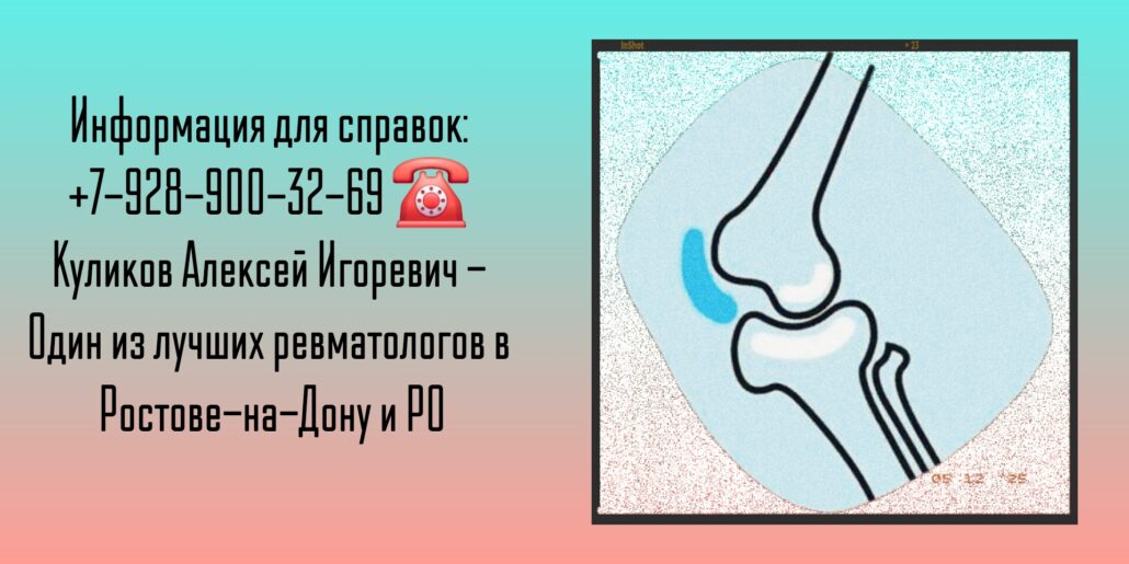 Ростов - опытный ревматолог - Куликов Алексей Игоревич 