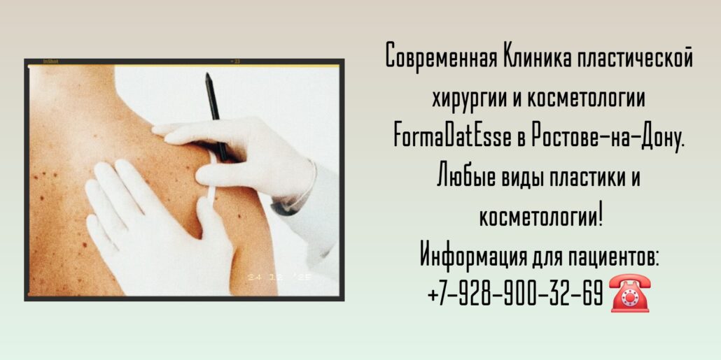 пластика груди ростов