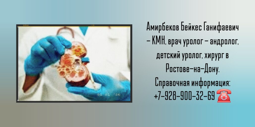 Ростов уролог - Амирбеков Бейкес Ганифаевич