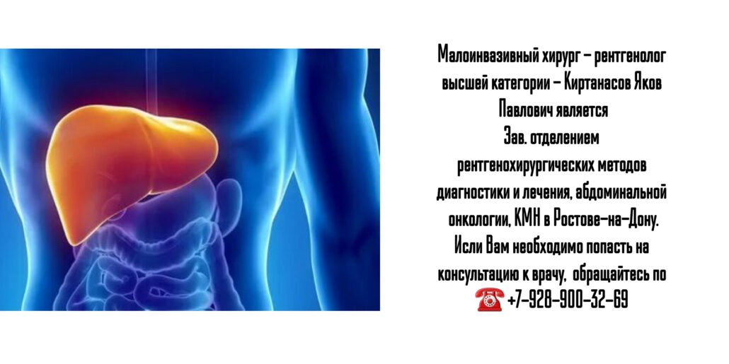 Малоинвазивный хирург - рентгенолог в Ростове-на-Дону - Киртанасов Яков Павлович