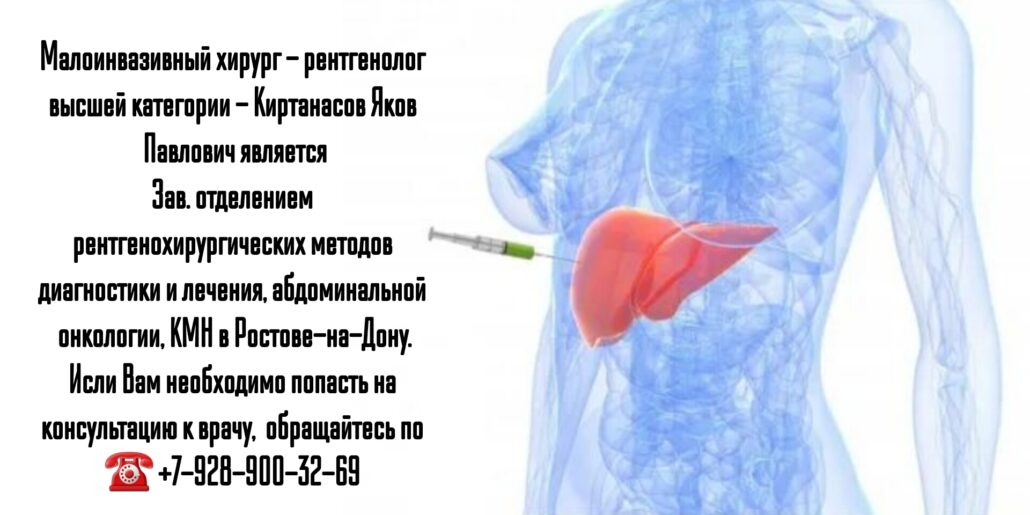 Малоинвазивный хирург - рентгенолог в Ростове-на-Дону - Киртанасов Яков Павлович