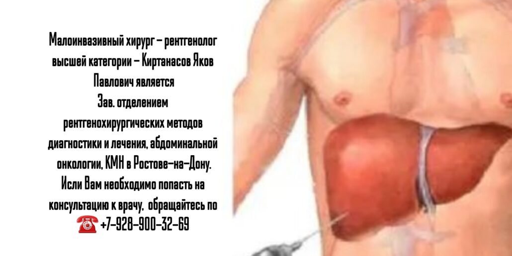 Малоинвазивный хирург - рентгенолог в Ростове-на-Дону - Киртанасов Яков Павлович