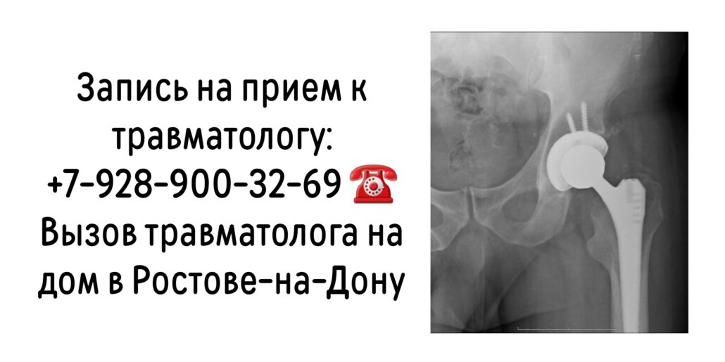 Дмитрий Сергеевич Чуйко - травматолог-ортопед в Ростове-на-Дону 