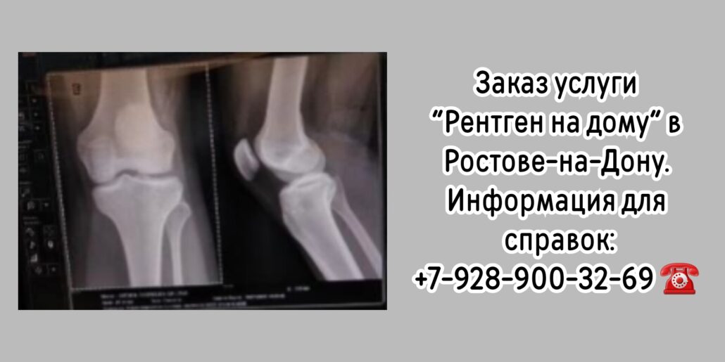Как сделать Рентген на дому в Ростове-на-Дону?