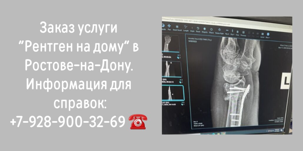 Как сделать Рентген на дому в Ростове-на-Дону?