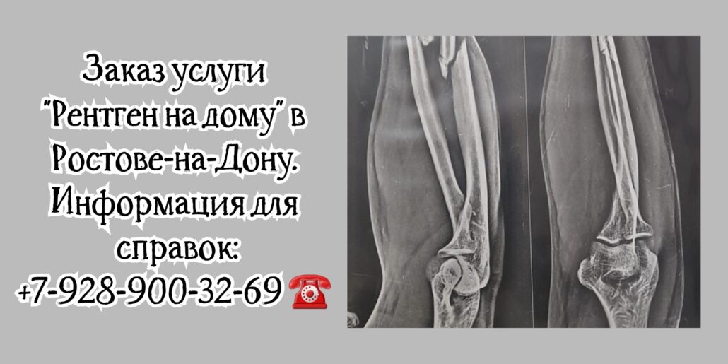 Как сделать Рентген на дому в Ростове-на-Дону?