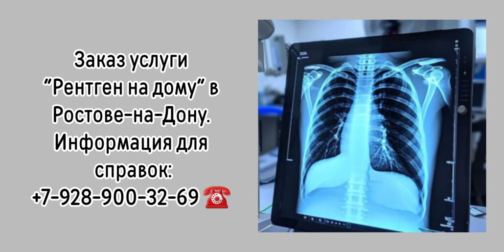 Как сделать Рентген на дому в Ростове-на-Дону?
