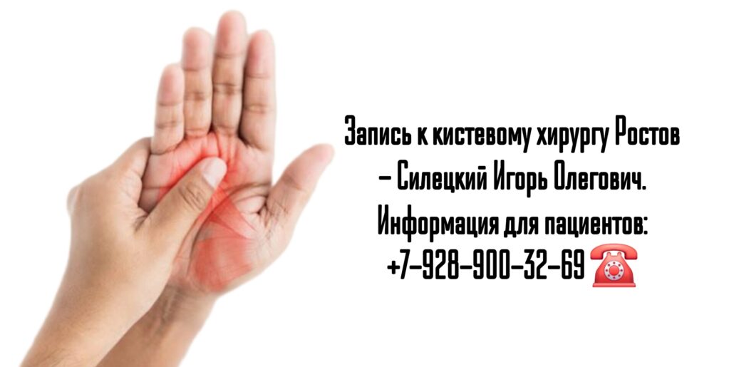 Консультация кистевого хирурга Ростов - Силецкий Игорь Олегович 