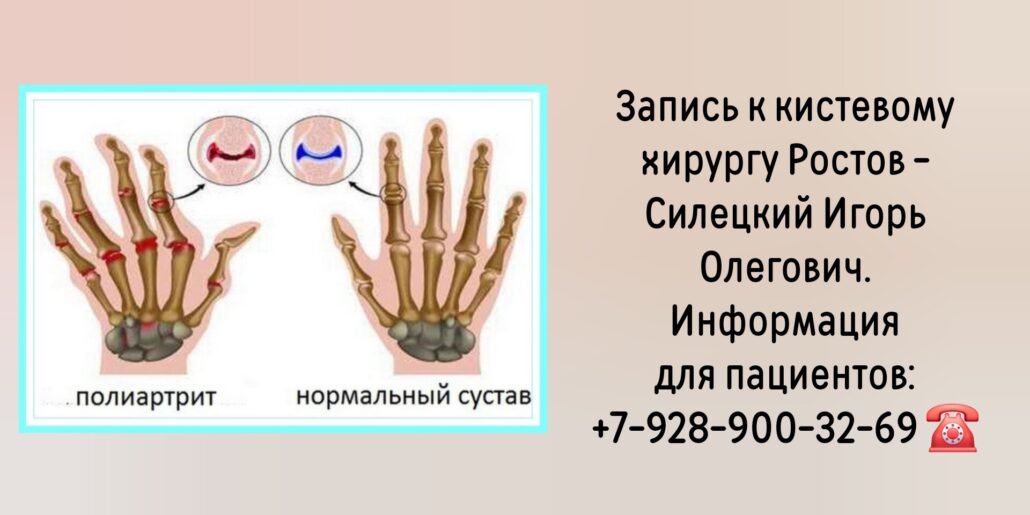 Консультация кистевого хирурга Ростов - Силецкий Игорь Олегович 