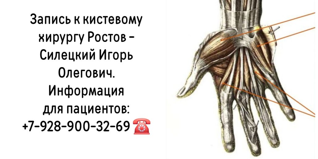 Консультация кистевого хирурга Ростов - Силецкий Игорь Олегович 