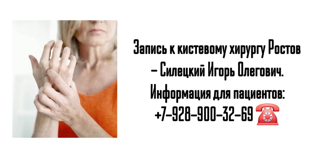 Консультация кистевого хирурга Ростов - Силецкий Игорь Олегович 