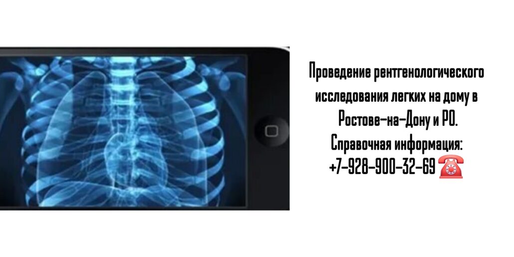 Рентген легких на дому - Ростов-на-Дону 