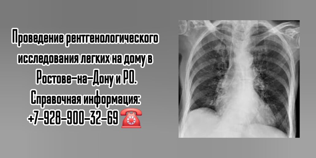 Рентген легких на дому - Ростов-на-Дону 