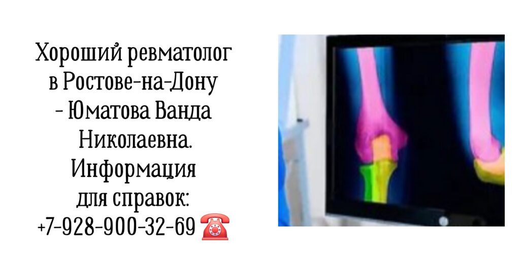 Юматова Ванда Николаевна- Ростов ревматолог 