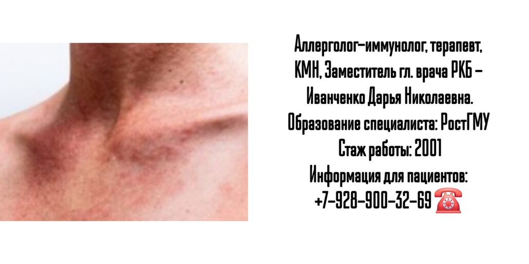 Иванченко Дарья Николаевна - аллерголог - иммунолог в Ростове-на-Дону