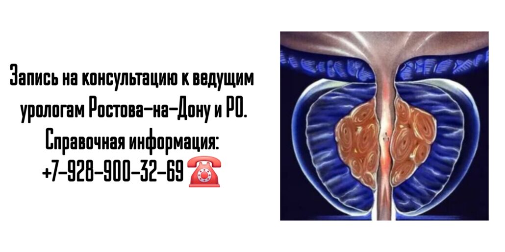 Идалов Аюб Абусаевич - уролог Ростов