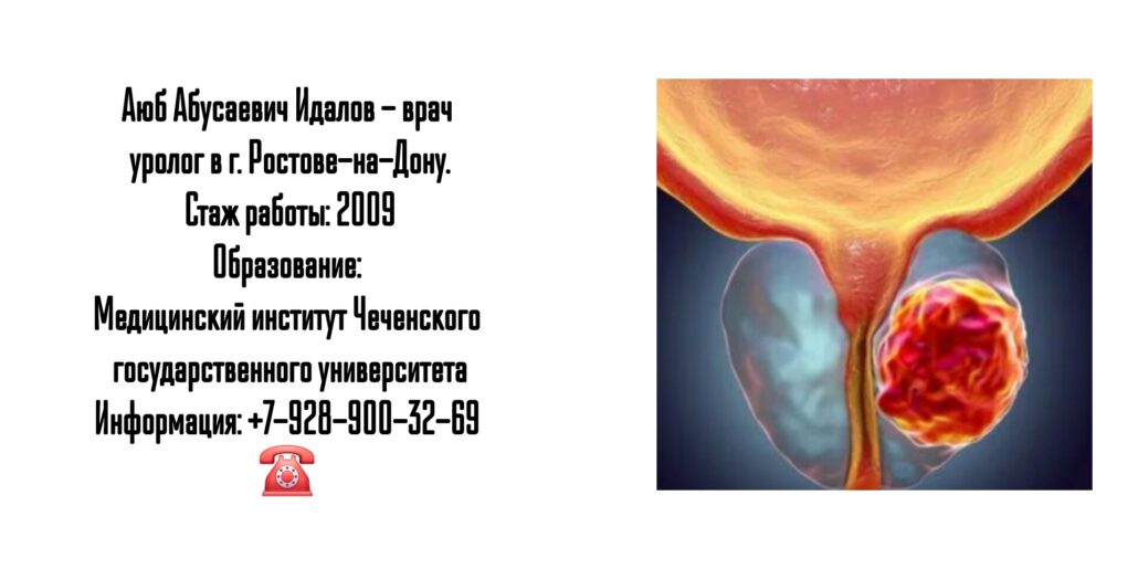 Идалов Аюб Абусаевич - уролог Ростов