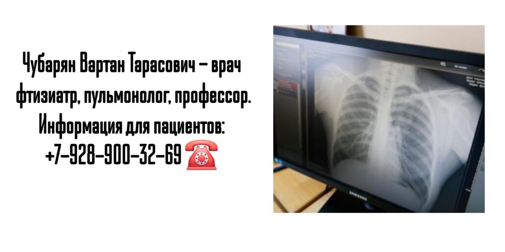 Запись к фтизиатру в Ростове-на-Дону- Чубарян Вартан Тарасович