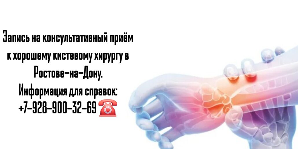 Хазарян Агоп Макарович- кистевой хирург Ростов 
