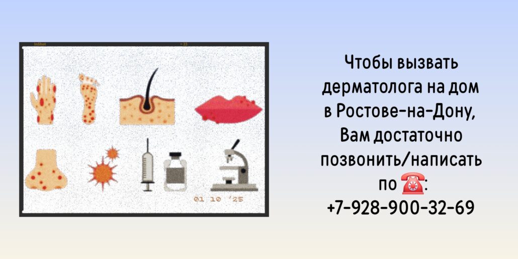 Дерматолог на дом Ростов-на-Дону 