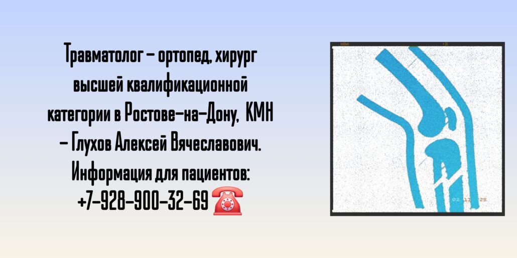 Ортопедия и травматология в Ростове-на-Дону - Глухов Алексей Вячеславович 
