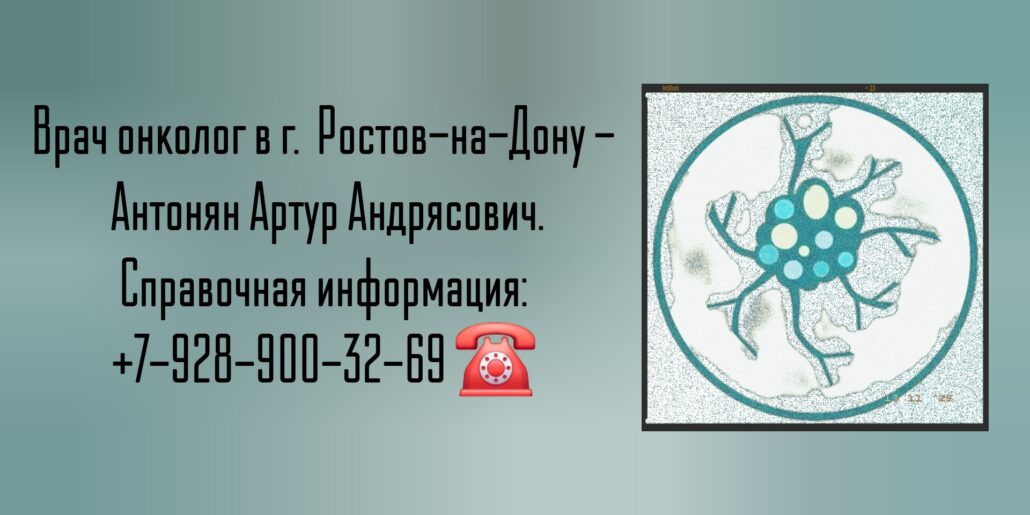 Антонян Артур Андрясович - онколог Ростов-на-Дону 
