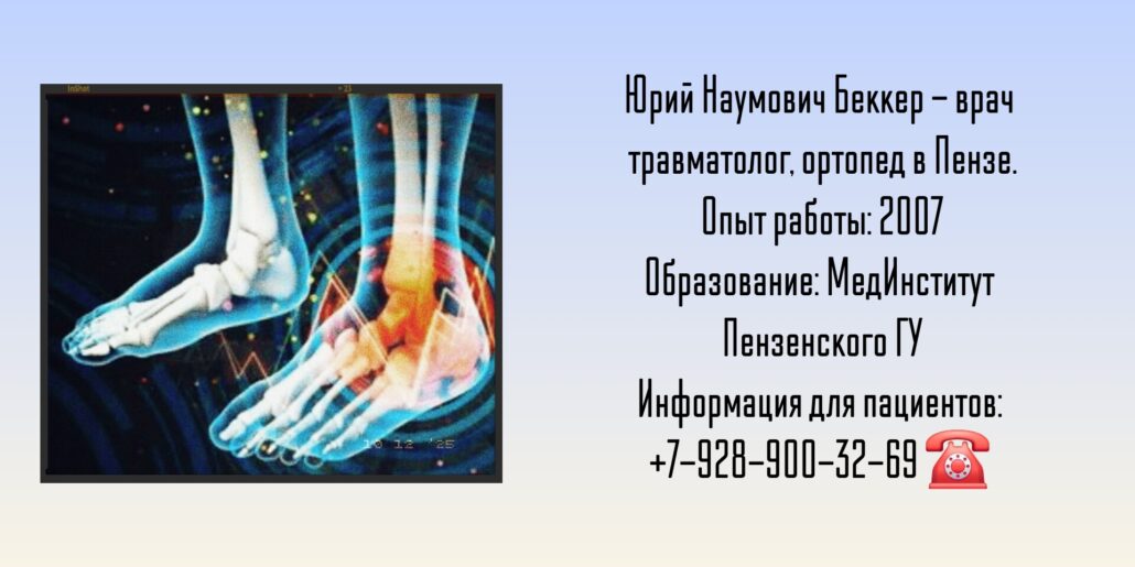 Беккер Юрий Наумович - травматолог в Пензе